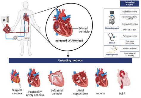 left ventricular unloading